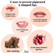 pigmented chapped dry lips