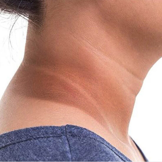 GET RID OF DARK NECK IN 10 MINUTES AT HOME