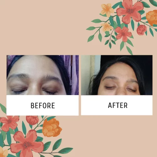 eye cream