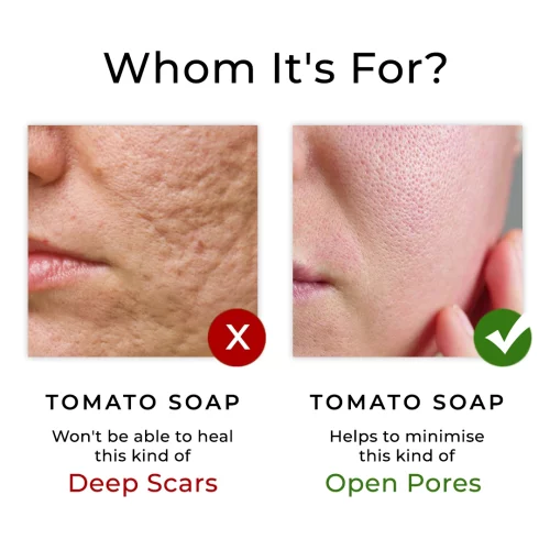 helps to minimize open pores