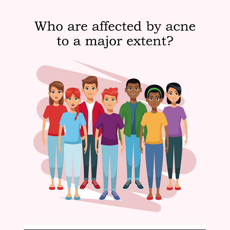 Who are affected by acne to a major extent?
