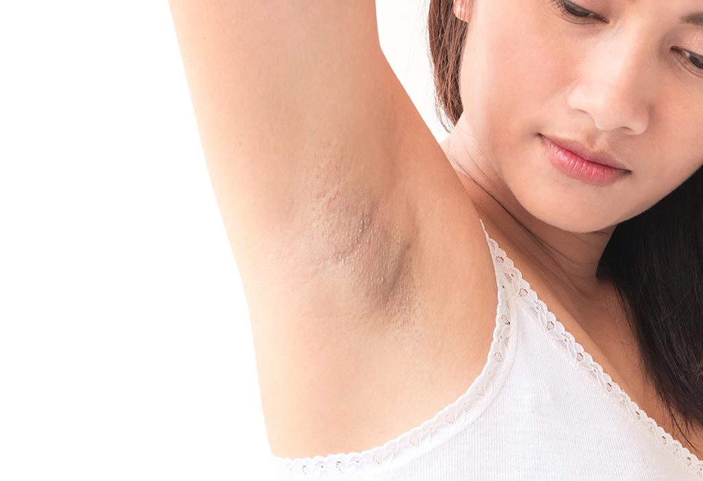 5 Effective ways to get rid of under Arm and Inner thigh darkness