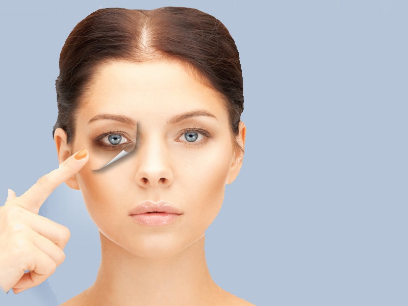 Get rid of dark circles with less effort!!!