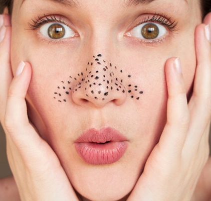 PERMANENT SOLUTION TO BLACKHEADS AT HOME