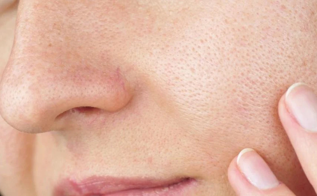 Ageing and large open pores