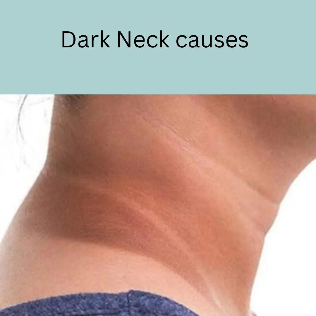 dark neck